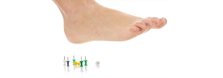 Chiropractic Calgary AB Foot Stepping On Tacks